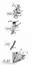 Fig. 06 - System for improving diastolic dysfunction