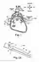 Fig. 02 - Ablation device with jaws