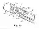Fig. 03 - Ablation device with jaws