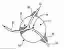 Fig. 01 - LOCAL EMBOLIZATION USING THERMOSENSITIVE POLYMERS