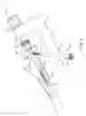 Fig. 07 - Bone fixation device, tools and methods