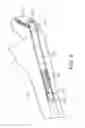 Fig. 09 - Bone fixation device, tools and methods