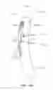 Fig. 43 - Bone fixation device, tools and methods