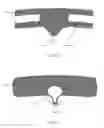 Fig. 07 - BONE FIXATION AND COMPRESSION SYSTEMS