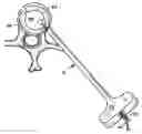 Fig. 01 - Devices and Injectable or Implantable Compositions for Intervertebral Fusion