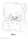 Fig. 06 - Device for Hygienic Extraction of an Acne Related Impaction