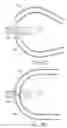 Fig. 40 - METHODS AND DEVICES FOR CONTINUOUS SUTURE PASSING
