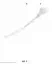 Fig. 06 - Flexor Tendon Suture Passer