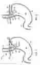 Fig. 02 - APPARATUS AND METHOD FOR MANIPULATING STOMACH TISSUE AND TREATING GASTROESOPHAGEAL REFLUX DISEASE