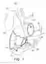 Fig. 06 - BILIARY DECOMPRESSION AND ANASTOMOSIS STENT