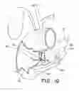 Fig. 09 - BILIARY DECOMPRESSION AND ANASTOMOSIS STENT