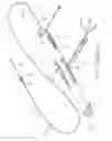 Fig. 02 - ROTATIONAL ATHERECTOMY DEVICE WITH KEYED EXCHANGEABLE DRIVE SHAFT