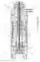 Fig. 05 - ROTATIONAL ATHERECTOMY DEVICE WITH KEYED EXCHANGEABLE DRIVE SHAFT
