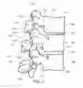 Fig. 03 - Minimally invasive discectomy