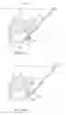 Fig. 32 - Minimally invasive discectomy