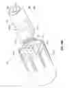 Fig. 49 - Minimally invasive discectomy