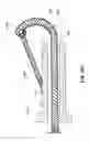 Fig. 58 - Minimally invasive discectomy