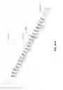 Fig. 67 - Minimally invasive discectomy