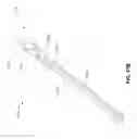 Fig. 68 - Minimally invasive discectomy
