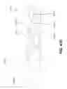 Fig. 70 - Minimally invasive discectomy