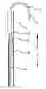 Fig. 01 - Device and Method for Transseptal Puncturing