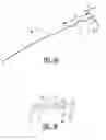 Fig. 02 - Device and Method for Transseptal Puncturing