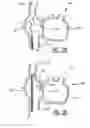 Fig. 03 - Device and Method for Transseptal Puncturing