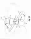 Fig. 07 - Tourniquet and method of use