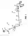 Fig. 02 - LAPAROSCOPIC INSTRUMENT WITH ATTACHABLE END EFFECTOR