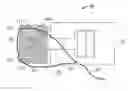 Fig. 01 - Tissue anchor applicator
