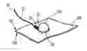Fig. 01 - Atraumatic Tissue Anchor