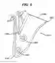 Fig. 06 - Absorbable bone anchor