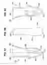 Fig. 07 - Absorbable bone anchor