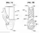 Fig. 08 - Absorbable bone anchor