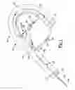 Fig. 02 - Soft tissue repair and conduit device