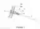 Fig. 02 - Spinous process fixation plate and minimally invasive method for placement