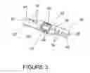 Fig. 04 - Spinous process fixation plate and minimally invasive method for placement