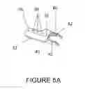 Fig. 06 - Spinous process fixation plate and minimally invasive method for placement