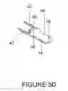 Fig. 09 - Spinous process fixation plate and minimally invasive method for placement