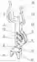 Fig. 01 - Unloading D-dynamic intervertebral device