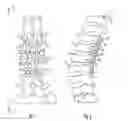 Fig. 02 - DEVICE FOR DYNAMIC STABILIZATION OF BONES OR BONE FRAGMENTS
