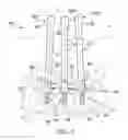 Fig. 05 - Deformable device for minimally invasive fixation