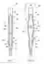 Fig. 07 - Deformable device for minimally invasive fixation
