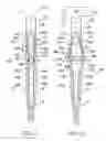 Fig. 08 - Deformable device for minimally invasive fixation