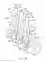 Fig. 10 - Deformable device for minimally invasive fixation