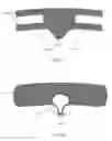 Fig. 07 - BONE FIXATION SYSTEMS