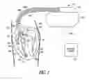 Fig. 02 - IMPLANTABLE DEVICE WITH HEMODYNAMIC SUPPORT OR RESUSCITATION THERAPY