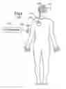 Fig. 02 - Implantable Interface for a Medical Device System