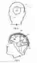 Fig. 04 - Implantable Interface for a Medical Device System