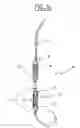 Fig. 17 - Method of treating aortic stenosis using an implantable prosthetic valve